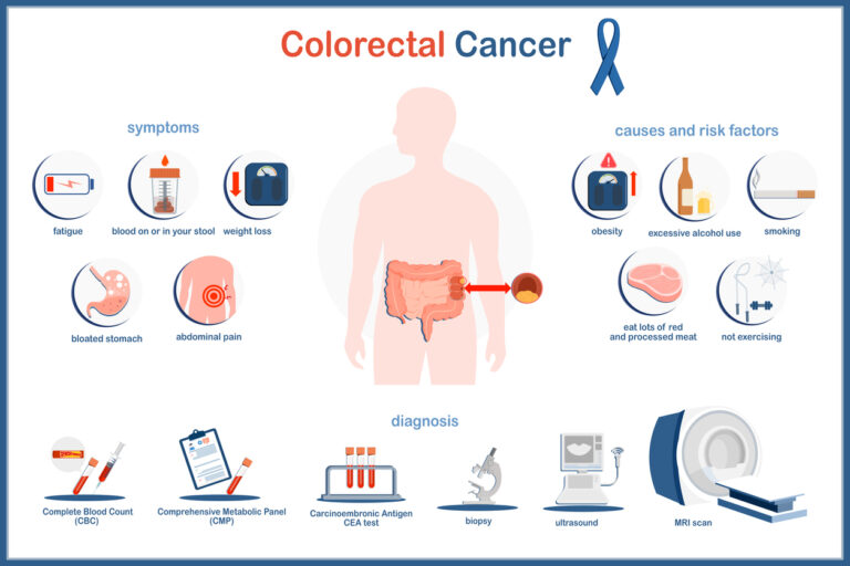 What Should You Know about Colorectal Screening Guidelines? 