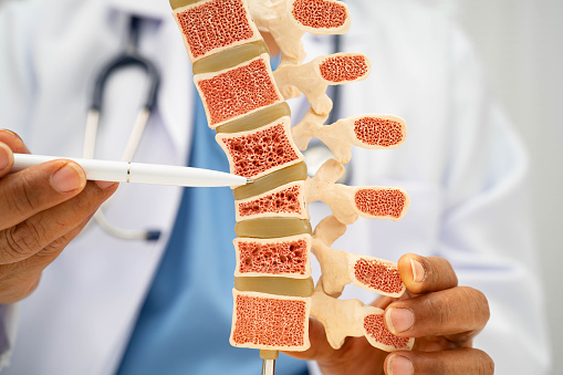 bone density scan Beverly Hills
