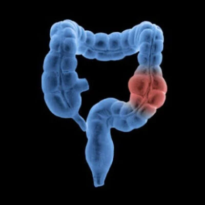 Way For Virtual Colonoscopy